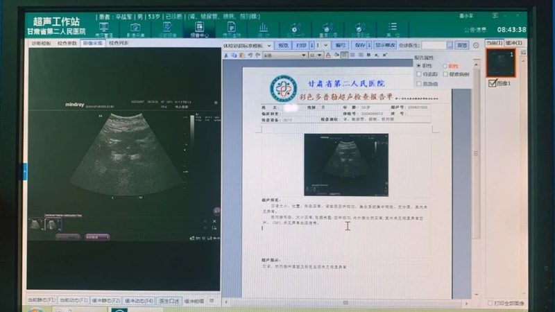 肾病慢病管理，遵循哪些标准流程？**